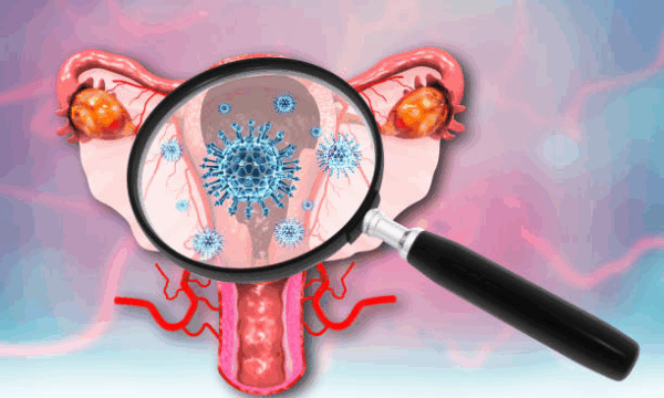 Genital herpes  - Image 2