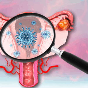 Trichomoniasis