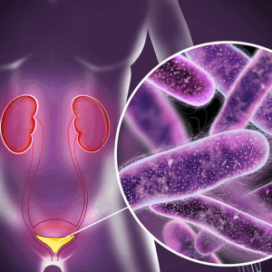Urinary Tract Infection