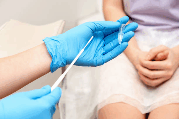 Gonorrhea - Image 4